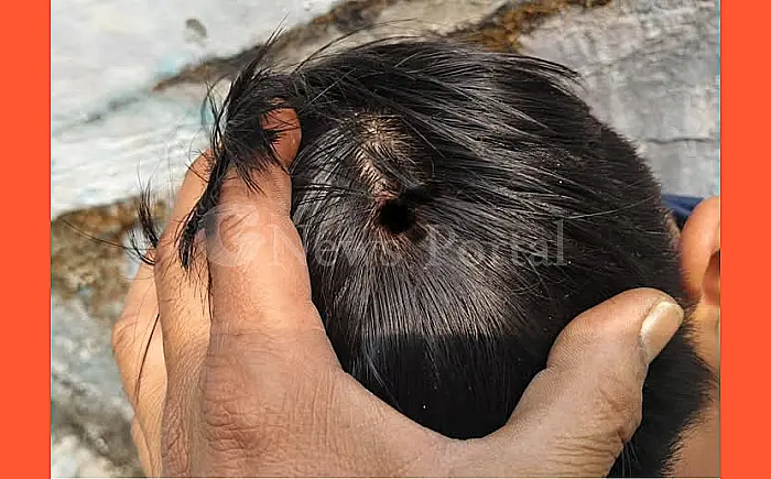 शर्मनाक: रेलवे ऑफिसर क्लब में समाज की पार्टी के दौरान बच्चे की बेरहमी से पिटाई, मीणा दंपत्ति पर गंभीर आरोप