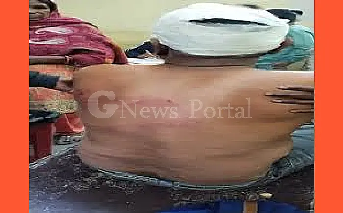 चाय की थड़ी पर युवक पर डंडों से हमला, CCTV में कैद हुई वारदात